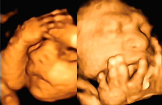 mouvement foetus mains
