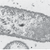  XYLEM-INHABITING FASTIDIOUS BACTERIA