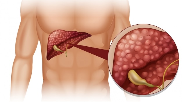 urobilinogen-trong-nuoc-tieu-la-gi 2