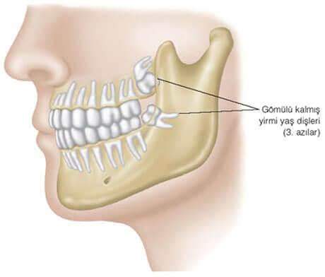 Bursa Dental Klinik Ağız ve Diş Sağlığı Hizmetlerimiz