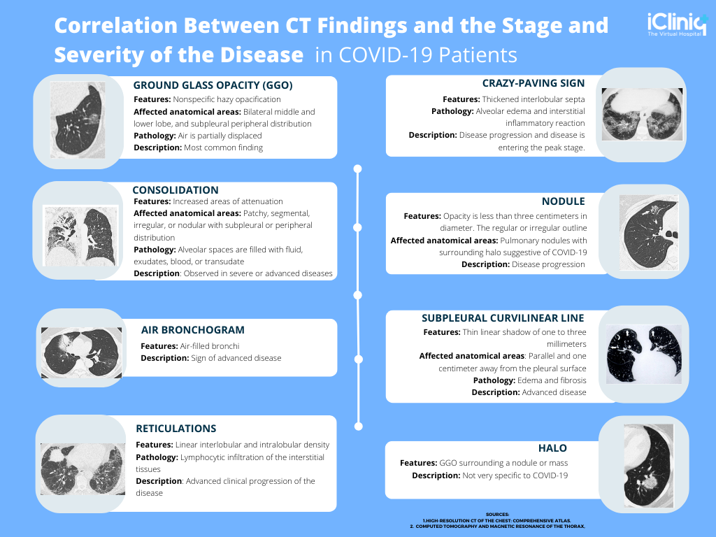 Various CT Findings and Their Importance