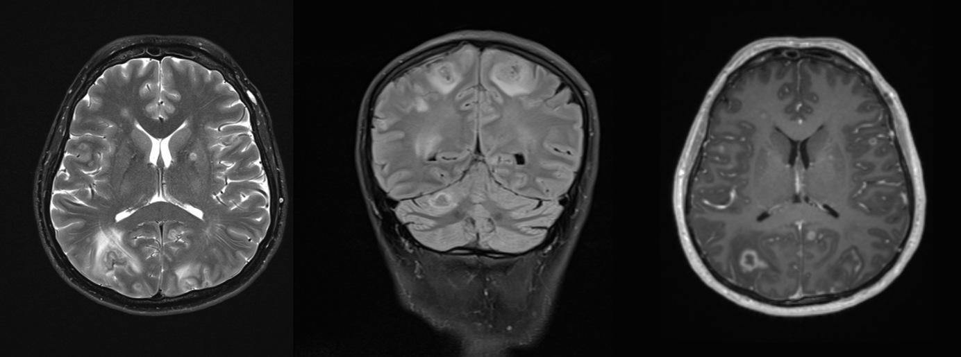 Ein Bild, das medizinische Bildgebung, Röntgenfilm, Röntgenstrahlung, monochrom enthält.Automatisch generierte Beschreibung mit mittlerer Zuverlässigkeit