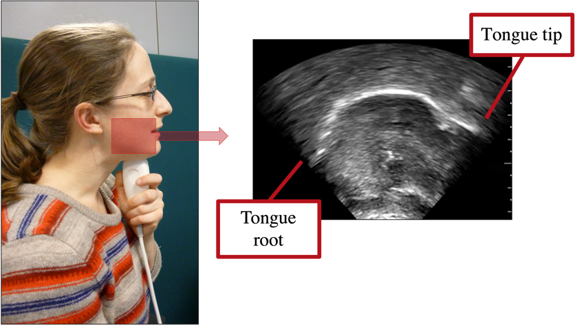 Fig 1. Example of the view typically obtained from ultrasound tongue imaging in phonetic research.