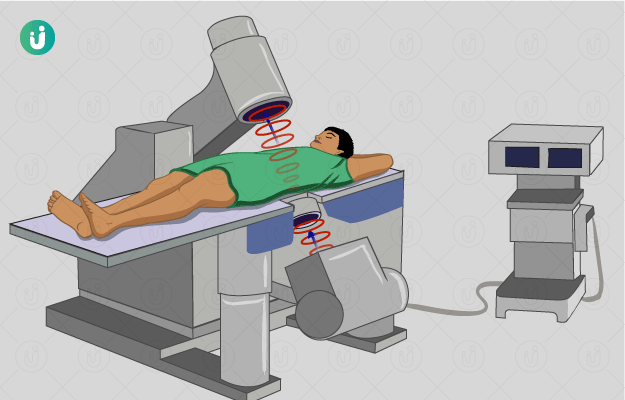 \\sghfslogix\UserData\sghd02800\Desktop\eswl-extracorporeal-shock-wave-lithotripsy-procedure-purpose-indications-recovery-results-cost-price.png