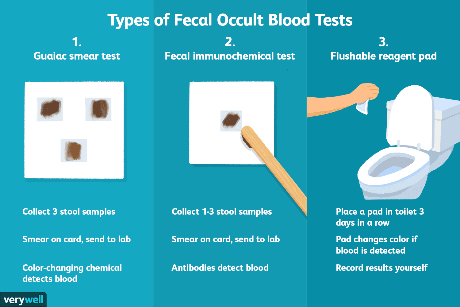 Fecal Occult Blood Test (FOBT): Uses, Procedure, Results