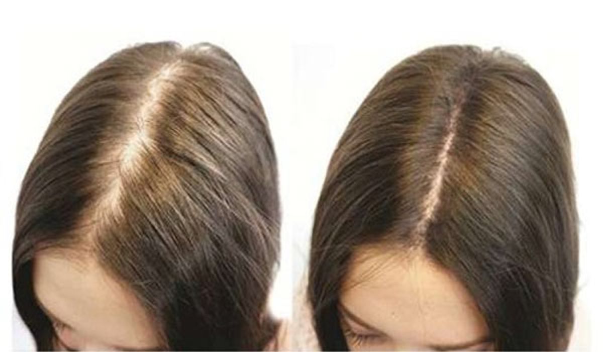 Cách để tóc dài nhanh và khỏe mạnh