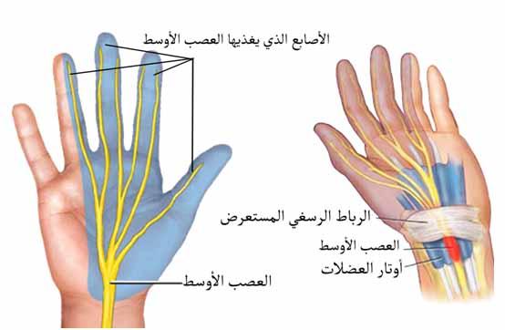 G:\article\Carpal tunnel syndrome\1.jpg