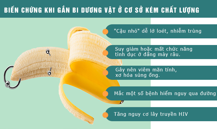 biến chứng khi thực hiện gắn bi tại cơ sở y tế kém chất lượng