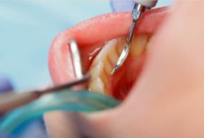 Dental Care Simplified

