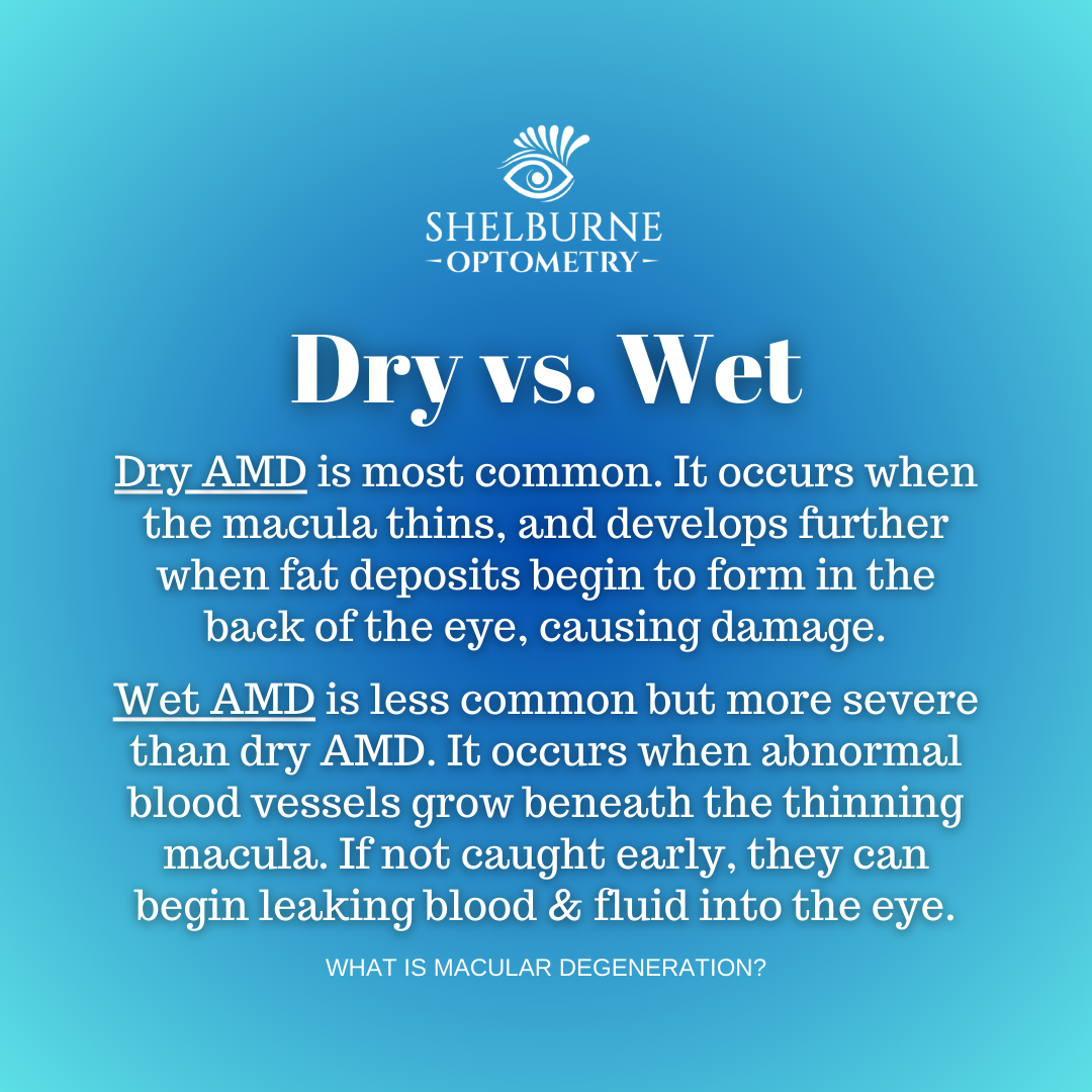 Dry AMD versus Wet AMD - Dry AMD is most common and occurs when the macula thins and fat deposits form in the back of the eye, causing damage. Wet AMD is less common but more severe, occurring when blood vessels grow beneath the thinning macula. They can begin leaking blood and fluid into the eye.