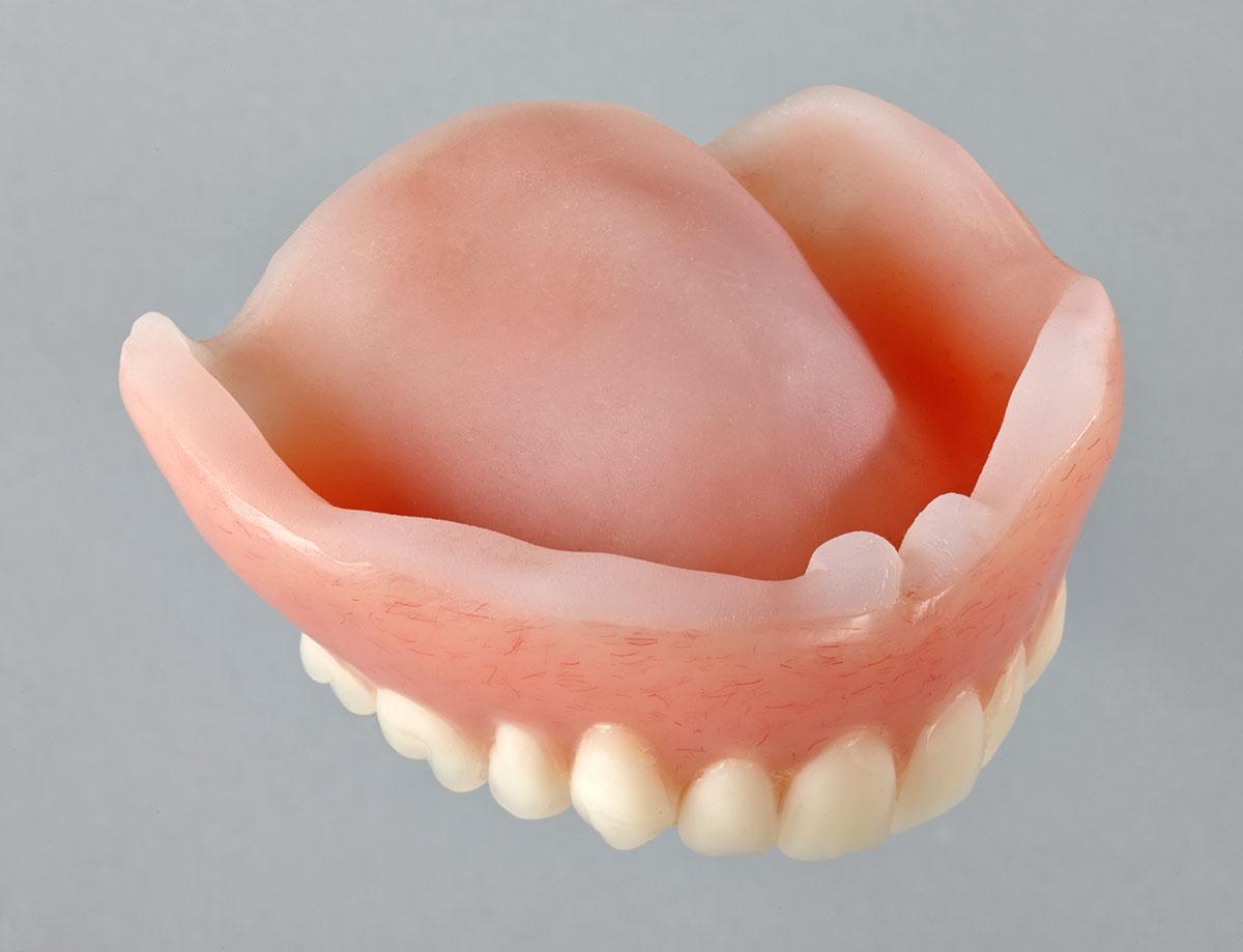 affordable dentures in Richmond Hill