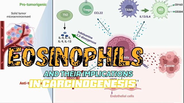 Eosinophils and their Implications in Carcinogenesis