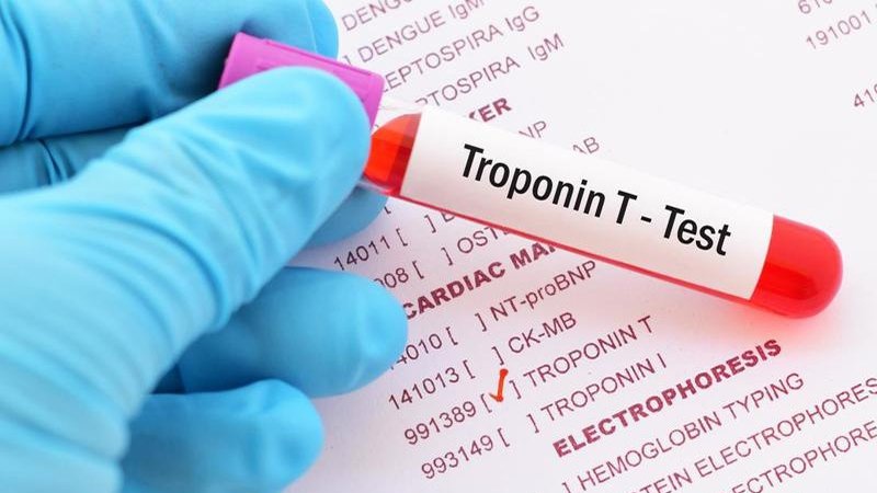 Xét nghiệm troponin T là gì? Ý nghĩa của xét nghiệm troponin T? 1