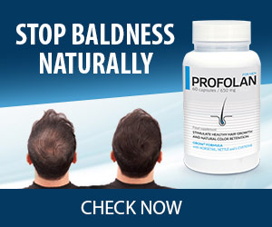 Stop Baldness Naturally