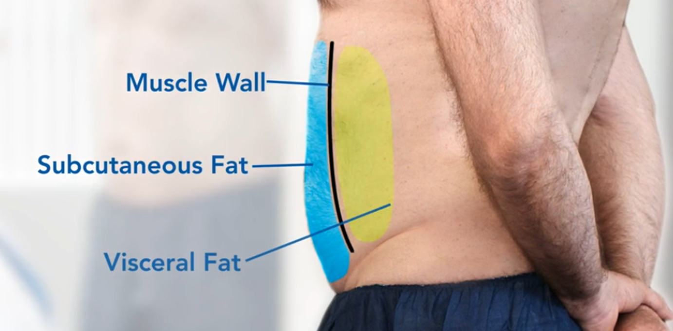 Illustration depicting the contrast between subcutaneous fat and visceral fat on a male client's body.