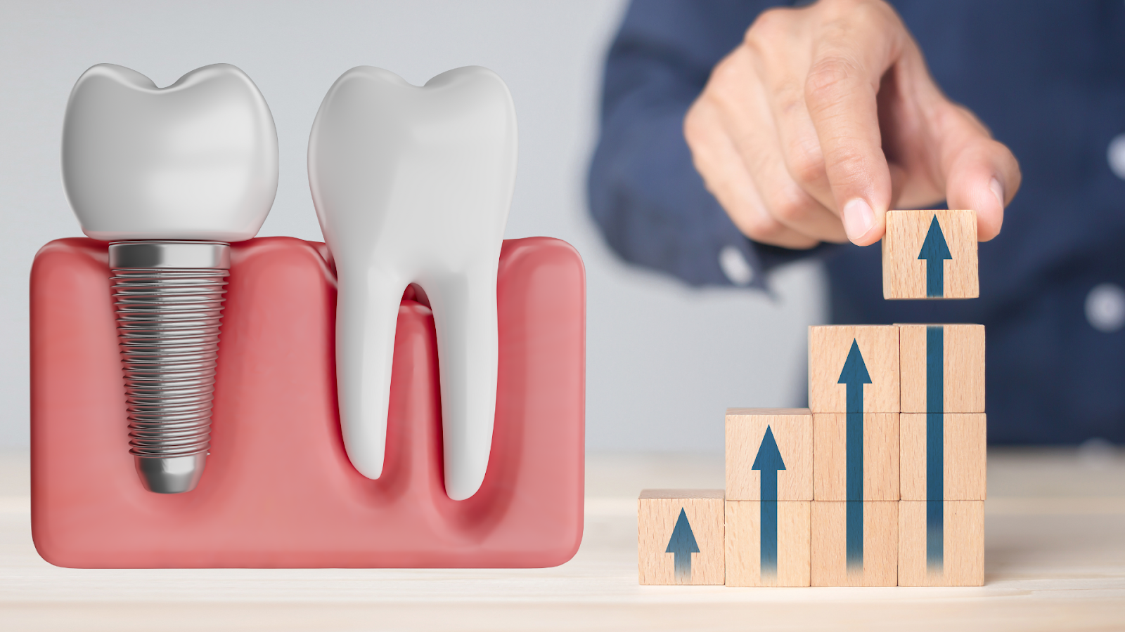 Dental Implant Marketing – The Beginning of the Sales Process