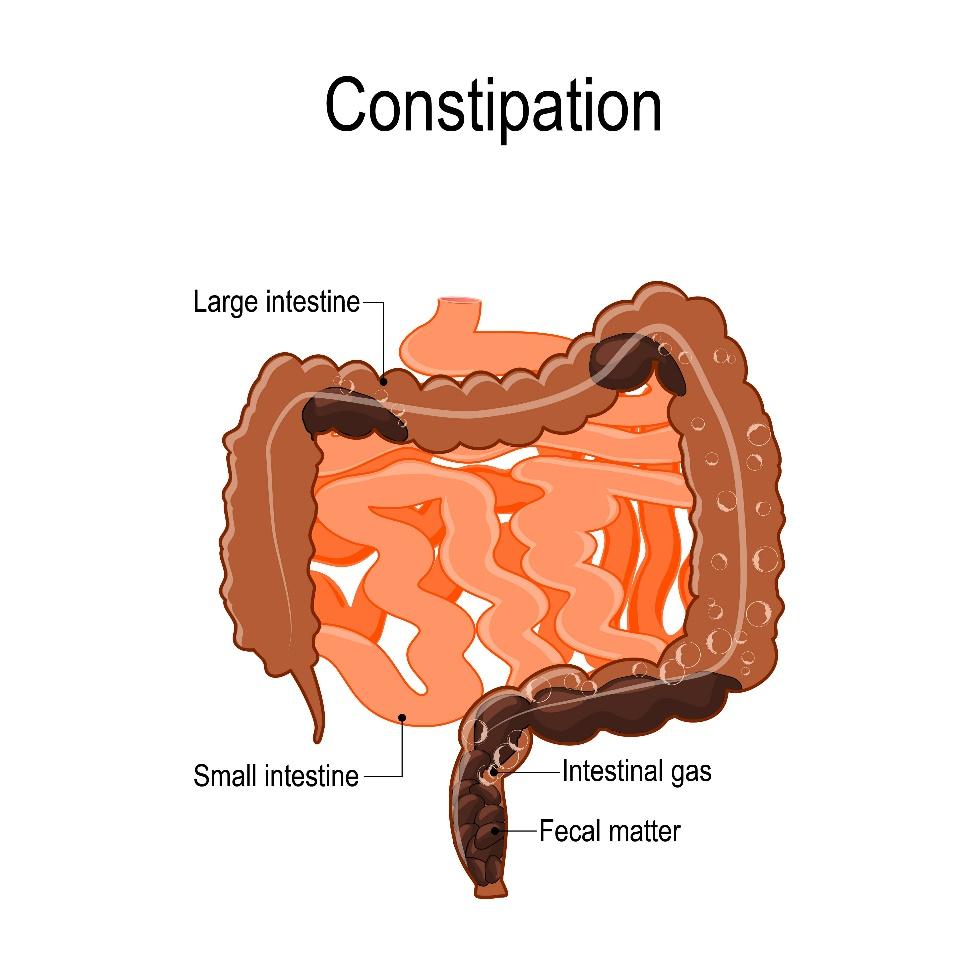 Understanding the Connection Between Constipation and Pelvic Floor Health |  Pelvic Health Physical Therapy - Morris County's Most Experienced Pelvic  Floor Team