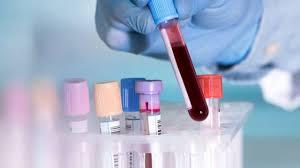 Kiểm tra chức năng đông máu với xét nghiệm PT