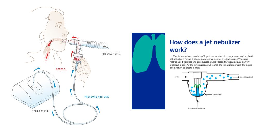 commonly used nebulizer