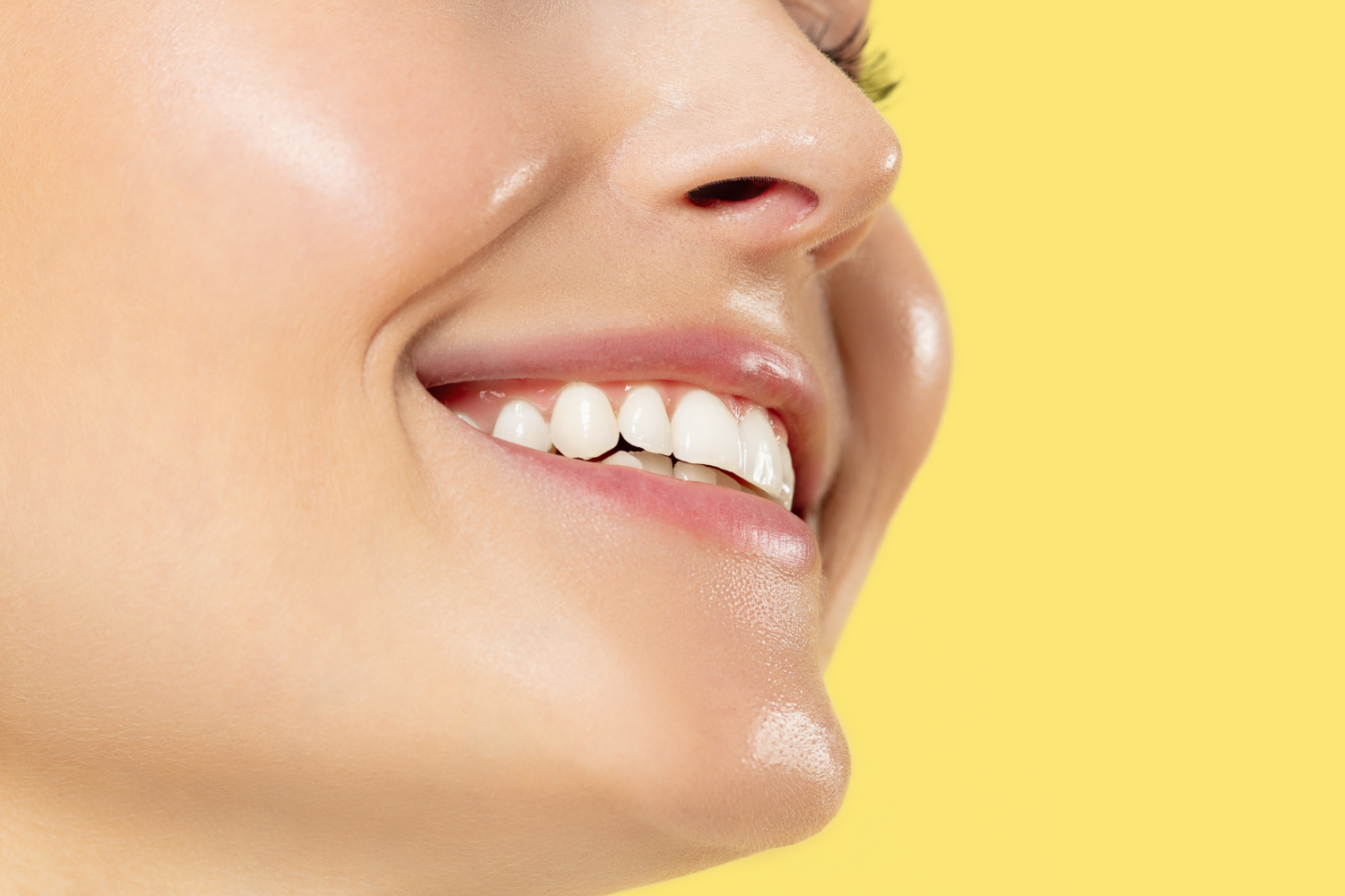 Răng sứ Emax giúp đem lại nụ cười rạng rỡ cho khách hàng