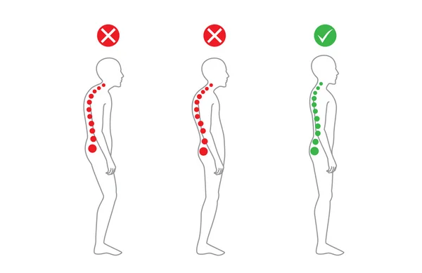 correct-standing-posture