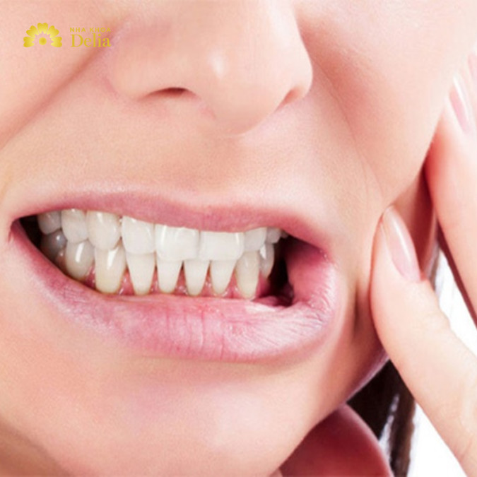 Nghiến răng thường xuyên có thể gây áp lực từ xương hàm lên khớp thái dương hàm