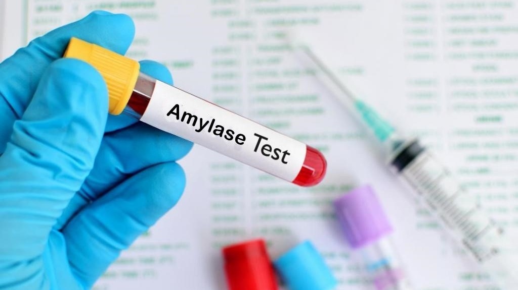 Xét nghiệm amylase giúp phát hiện và chẩn đoán bệnh lý tuyến tụy 1