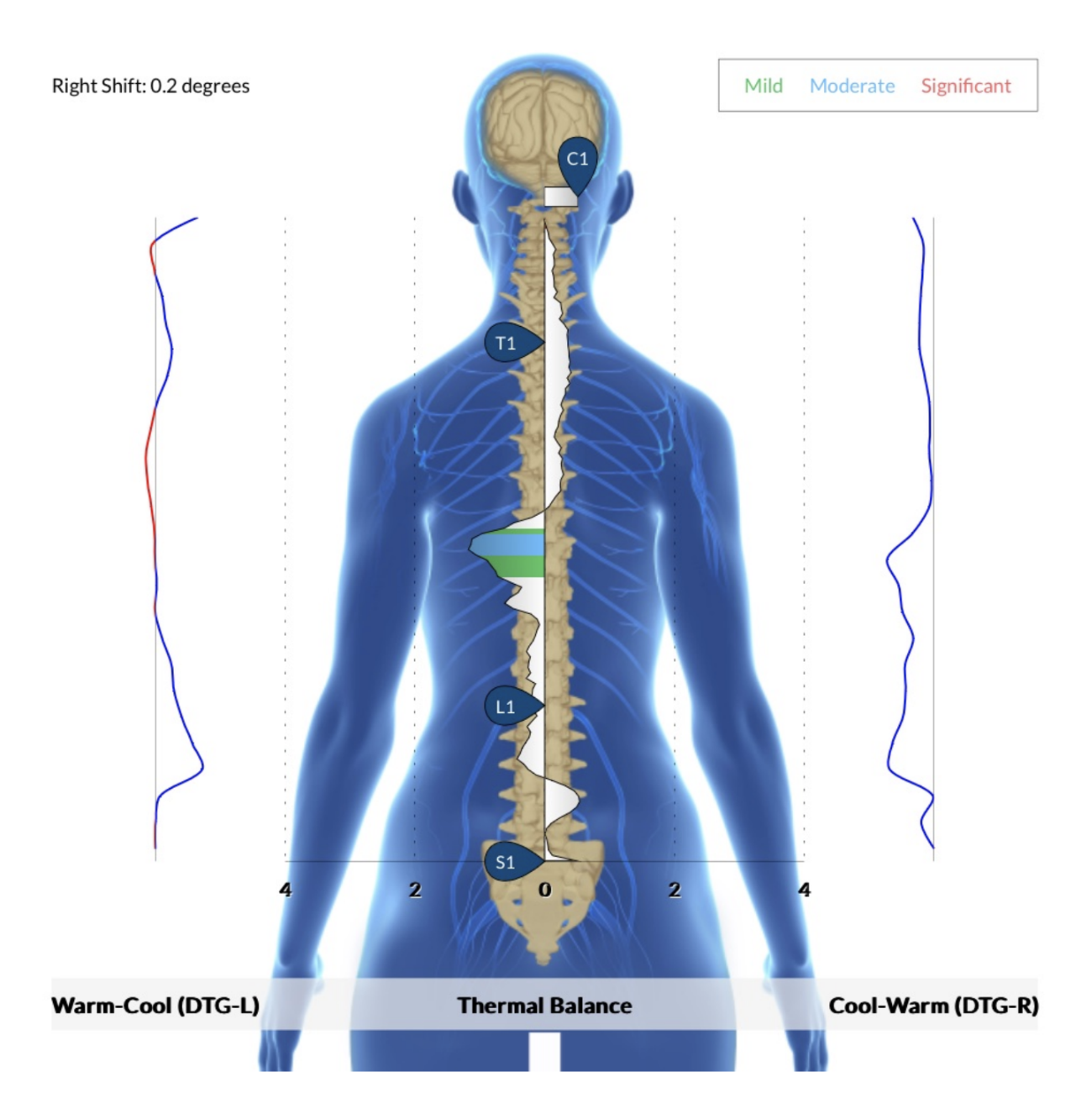 The Roadmap to Chronic Stress + Exhaustion: The 3 Stages of Subluxation | PX Docs