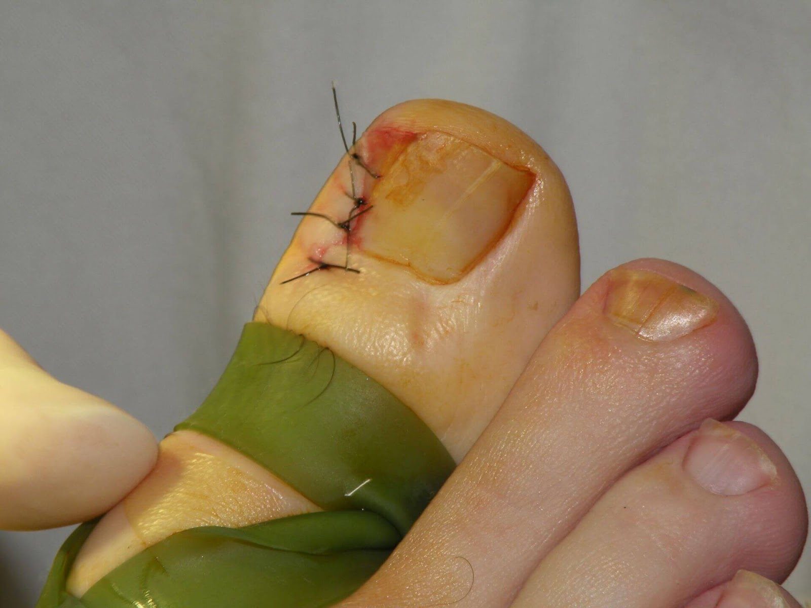 Toenail Cleaning Service Is A Part Of Podiatry
