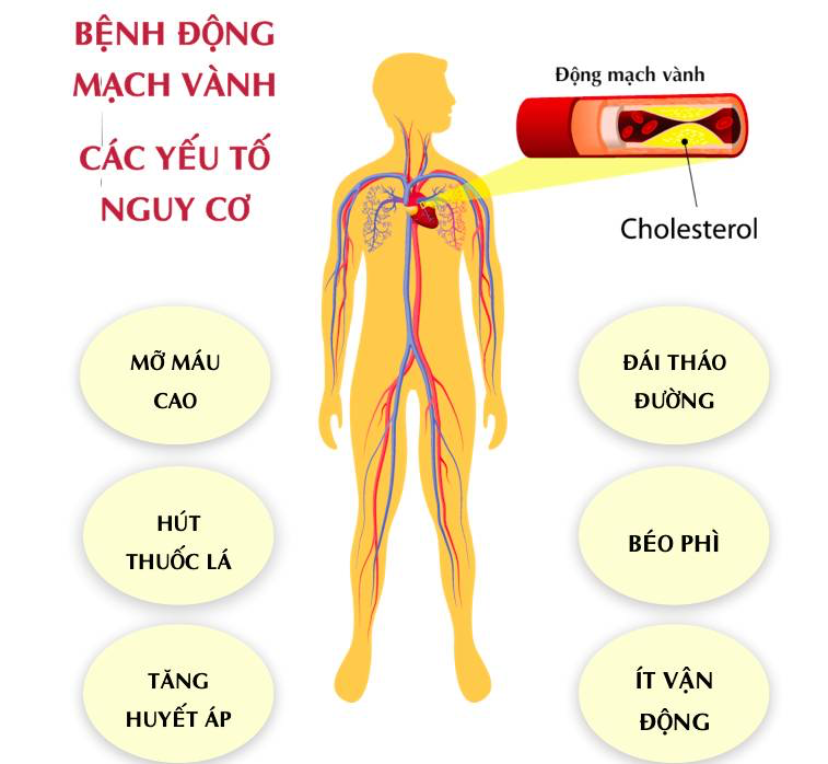 mạch-vanh-2