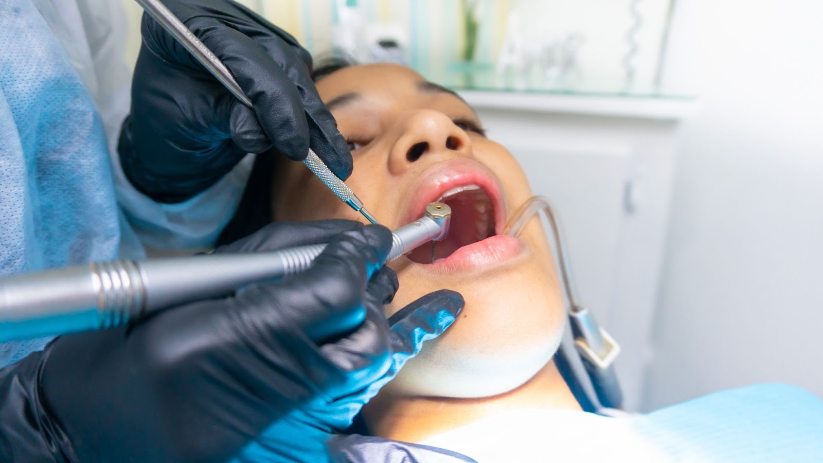a close up of a patient receiving dental work, and a hygienist cleaning her teeth with dental instruments