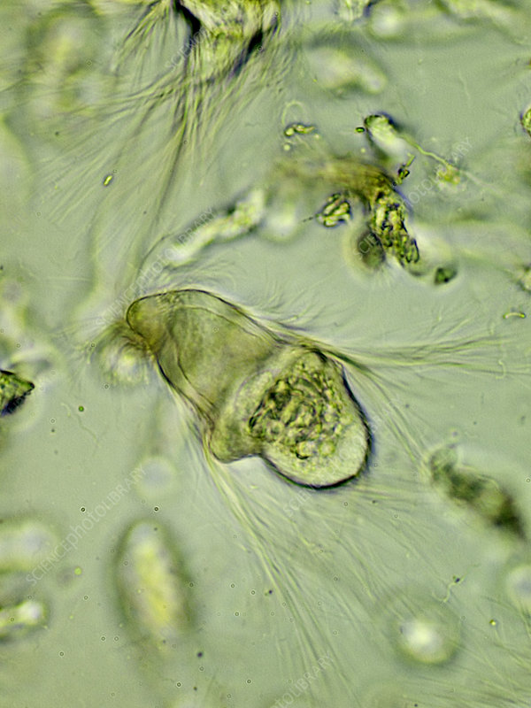 Protozoa (Trichonympha sp.), LM - Stock Image - C030/4922 - Science Photo  Library