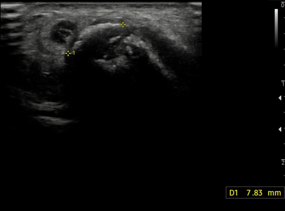 A ultrasound of a baby Description automatically generated