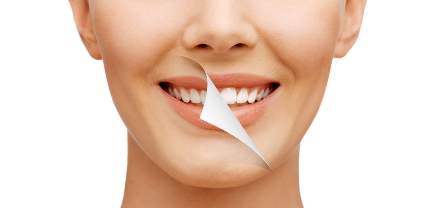 cosmetic dentistry in North York