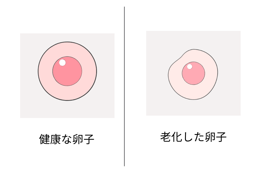 健康な卵子と老化した卵子