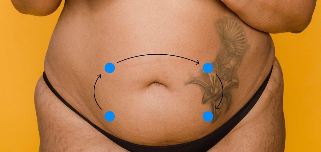 Abdomen – Auscultation – Introduction to Health Assessment for the Nursing  Professional – Part I