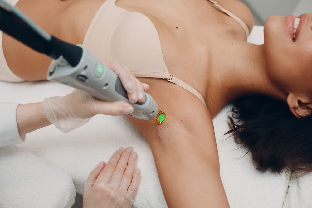 epilation laser des aisselles sur une jeune femme a la peau mate