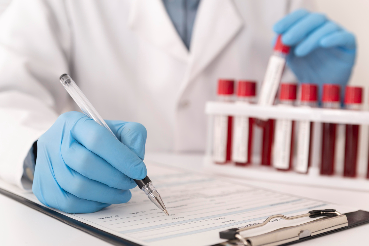 Người bệnh nên nắm được các chỉ số quan trọng trong giấy xét nghiệm máu sốt xuất huyết
