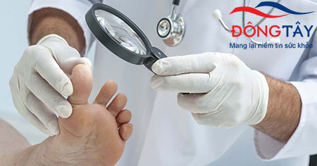 Người bệnh cần đi khám để phát hiện biến chứng tiểu đường ở chân