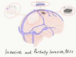 Brain–computer interface - Wikipedia