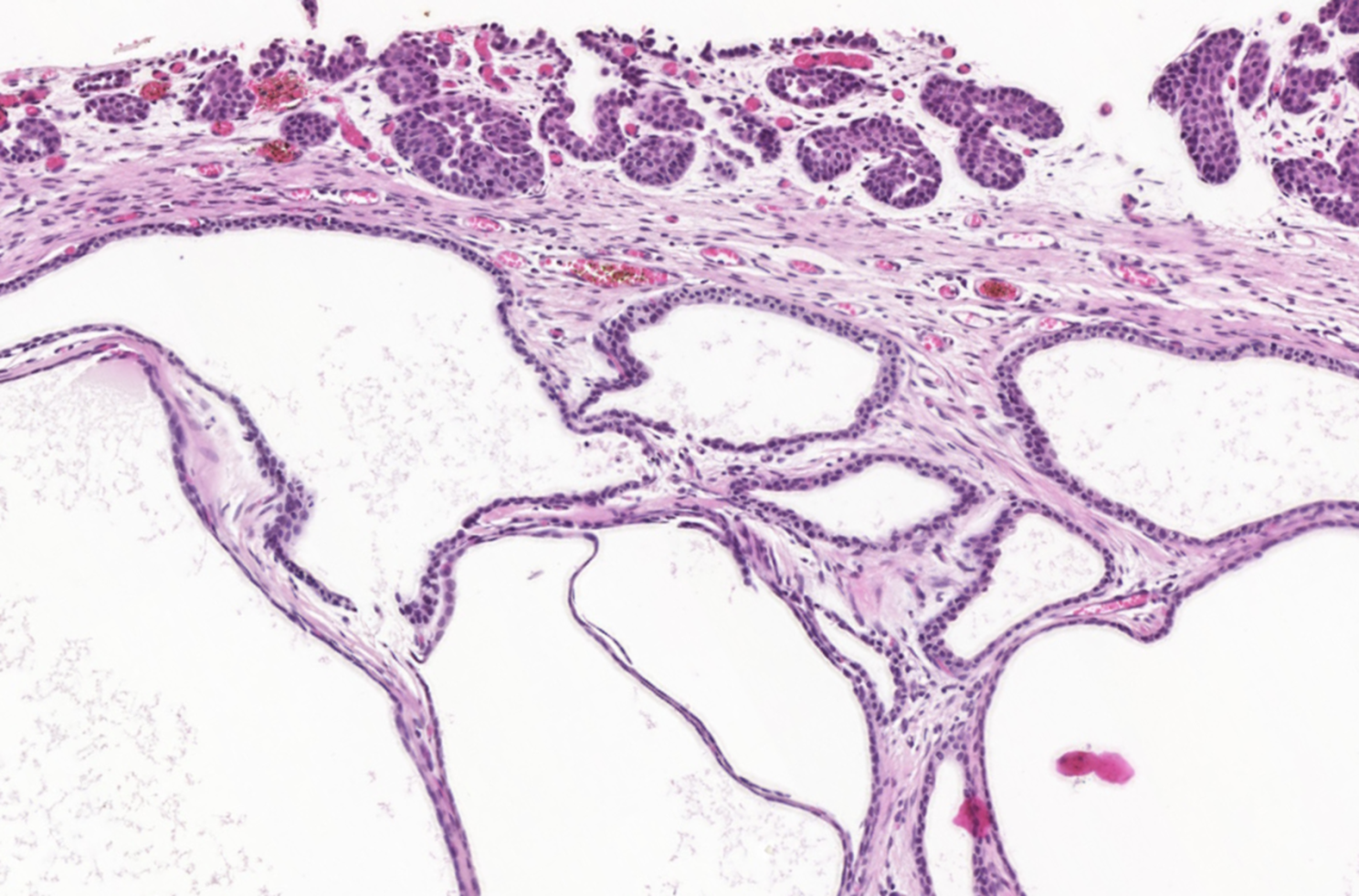A microscope view of a human tissue

Description automatically generated