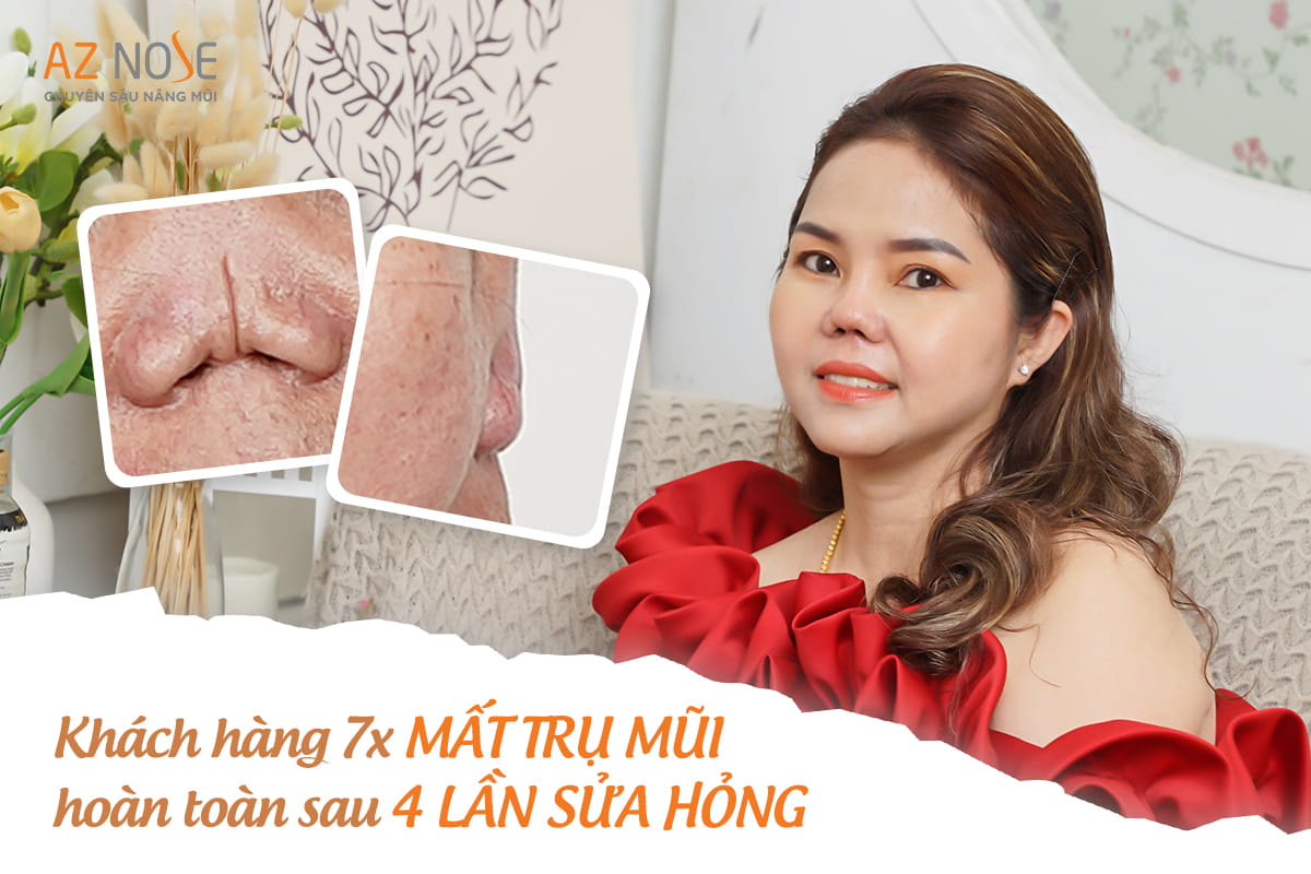 Sửa Mũi Hỏng: Cải Thiện Dáng Mũi và Tự Tin Hơn QACJdCr7wIHdPp0gJ4LhZ-zYeEMERkRrrpq-PiLAncnXTIYIz_BqnPf9244AjK91kiShGxnY3C6trrlPVglv-iLnnRsXMouWyvg6LV71aV1FYtJBtDCWSqntSBNDPsDjoIwrBwPIofWdRNC02Lb0-A4