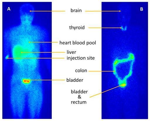 A blue and green x-ray of a person

Description automatically generated