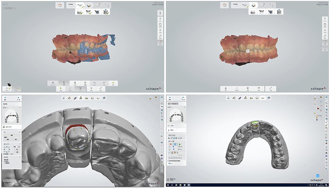 AI used for scanning and 3D printing of dentition in dentistry.