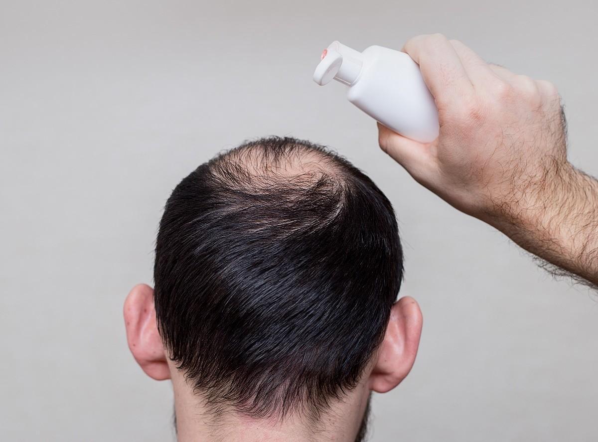 Hair strength shampoo fixes premature scalp aging. Source: HRBR