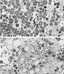 Transmission electron microscopy images of secretory vesicles in growth...  | Download Scientific Diagram