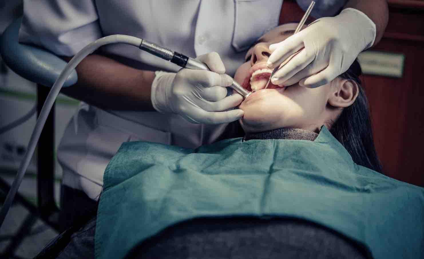 Root Canal and Tooth Extraction