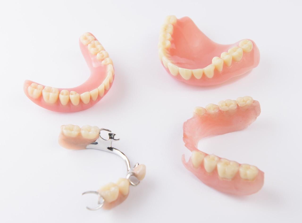 affordable denture fabrication in Richmond Hill 