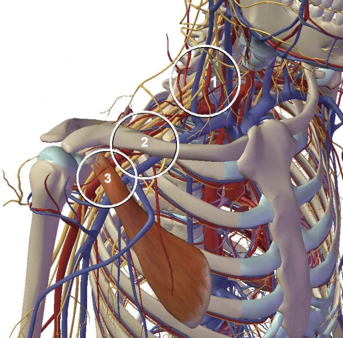 Fibrosi nel contesto del lipedema: strategie di intervento e gestione