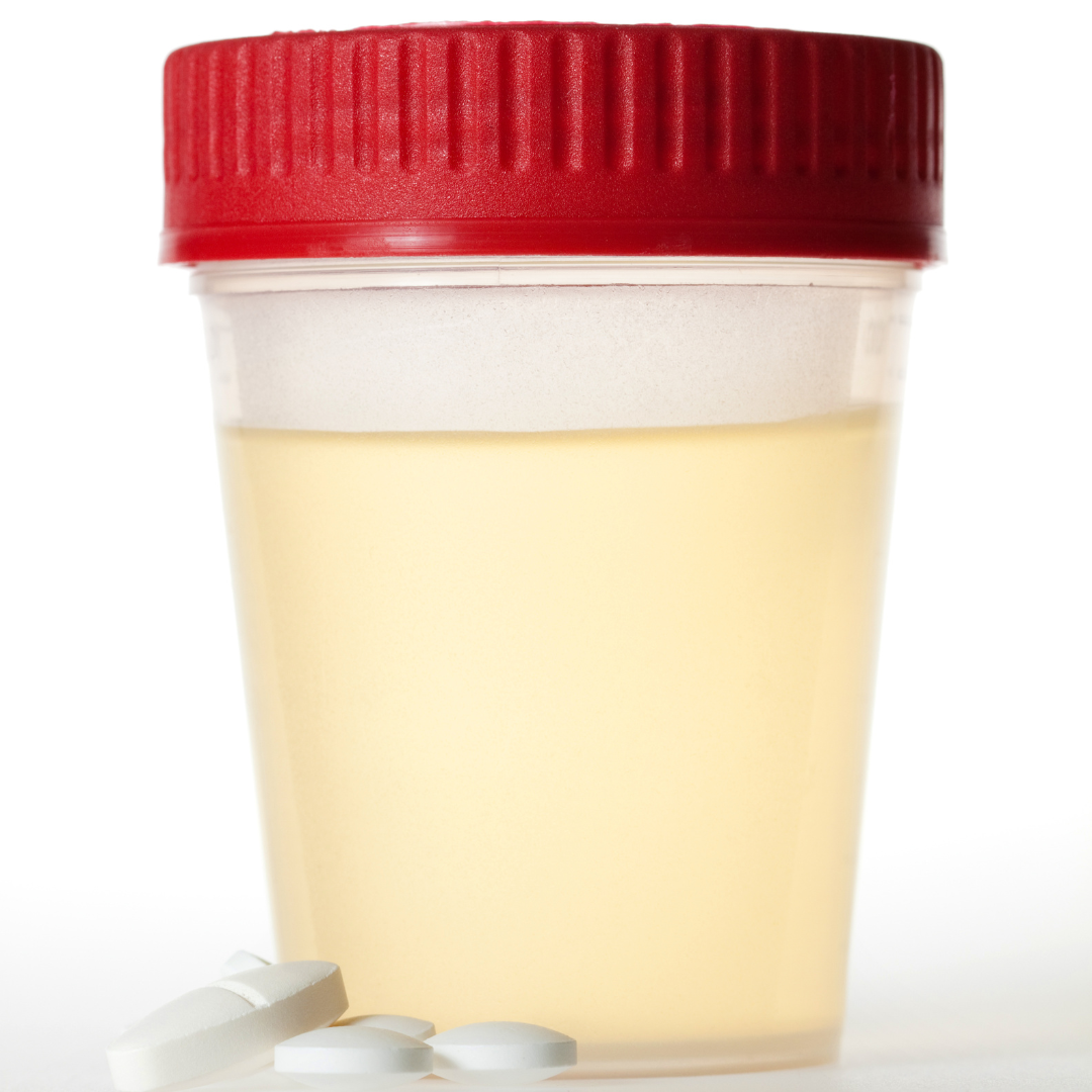 Wholesale Deals for Drug Test Supplies